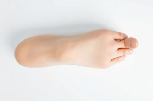 발바닥 굳은살 원인과 안전한 제거 방법 51 example 69